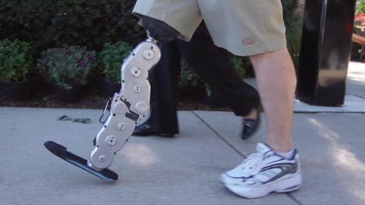 ric-vanderbilt-bionic-leg-3.jpg