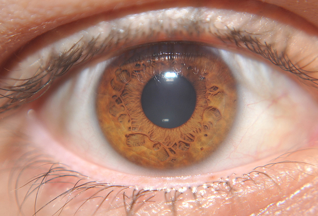 brown-eye-1.jpg