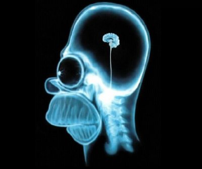 600x500xHomer-Brain-X-Ray-the-simpsons-60337_1024_768.jpg.pagespeed.ic.wLljXogtcQ.jpg