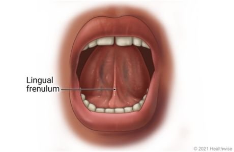 frenulum.jpg